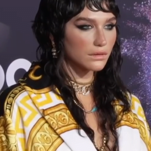 Photo of Kesha
